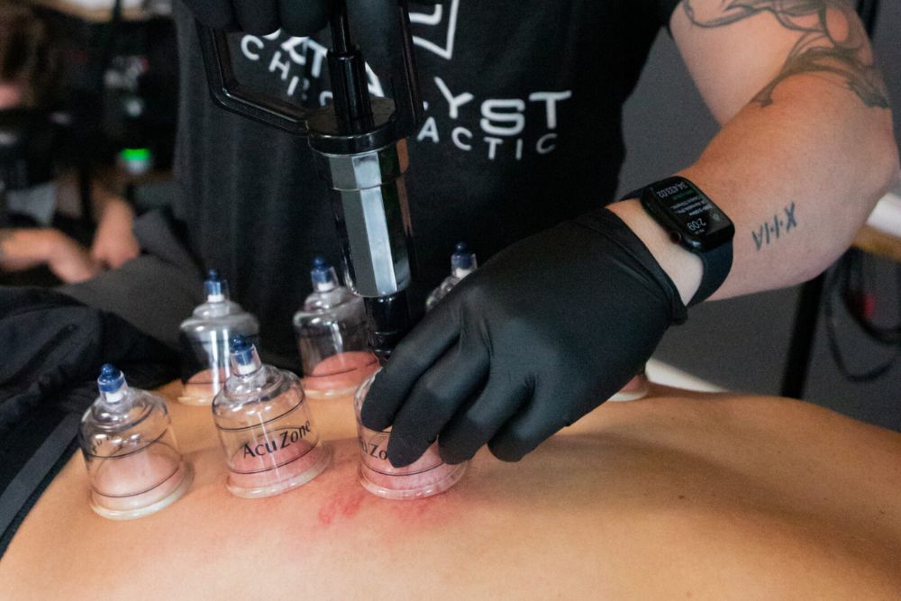 cupping treatment laying down
