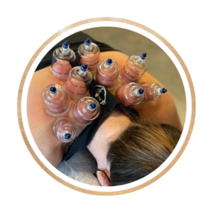 cupping icon of female getting treatment on upper back and shoulders