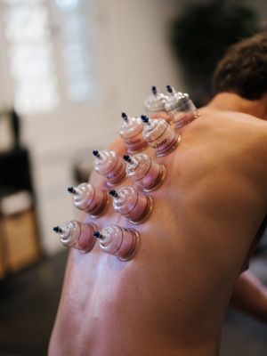 large cupping