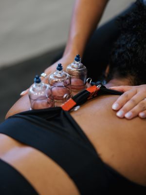 female patient cupping procedure