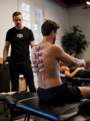 doing cupping treatments